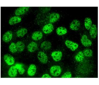 c Fos Antibody D 1 SCBT Santa Cruz Biotechnology