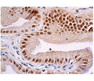 c Fos Antibody D 1 SCBT Santa Cruz Biotechnology