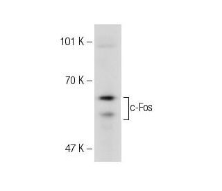 c-Fos Antibody (E-8) - Western Blotting - Image 148650