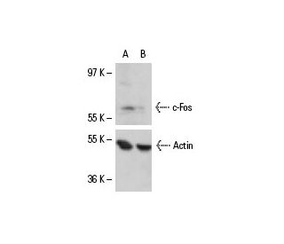 c-Fos siRNA (h): sc-29221. Western blot analysis of c-Fos expression in non-transfected control (A) and c-Fos siRNA transf 