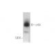 western blotting image from recommended c-Kit (E-3) monoclonal antibody replacement. Image 349933