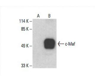c-Maf Antibody (E-7) - Western Blotting - Image 393592Each CRISPR/Cas9 Knockout (KO) Plasmid product consists of a pool of 3 plasmids designed to ensure identification and cleavage of a specific gene for maximum knockout efficiency. Each plasmid encodes a unique 20 nt sequence derived from the GeCKO (v2) library. 
