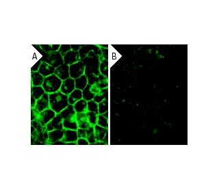 c-Src siRNA (h): sc-29228. Immunofluorescence staining of methanol-fixed, control HeLa (A) and c-Src siRNA silenced HeLa ( 