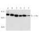 This polyclonal antibody has been discontinued. See our recommended <a href="c-yes-antibody-c-10">Yes (C-10)</a> monoclonal antibody (sample data shown). western blotting image from recommended Yes (C-10) monoclonal antibody replacement. Image 358454