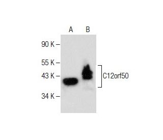 C12orf50 Antibody (E-1) - Western Blotting - Image 282608 