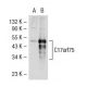 C17orf75 Antibody (H-17) - Western Blotting - Image 35077