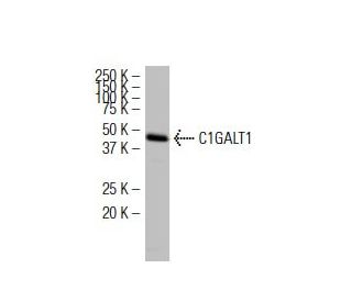 C1GALT1 Antibody (F-31) - Western Blotting - Image 34119SAM Transcription Activation: SAM system utilizing dCas9-VP64, MS2-P65-HSF1, and sgRNA for precise gene transcription activation.