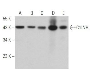 C1INH Antibody (B-11) - Western Blotting - Image 363907 