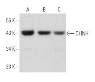 C1INH Antibody (B-11) - Western Blotting - Image 358080