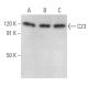 This polyclonal antibody has been discontinued. See our recommended <a href="c23-antibody-ms-3">C23 (Nucleolin) (MS-3)</a> monoclonal antibody (sample data shown). western blotting image from recommended C23 (Nucleolin) (MS-3) monoclonal antibody replacement. Image 354358