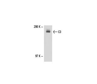 C3 Antibody (2898) - Western Blotting - Image 17970 