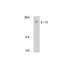 C5 Antibody (557) - Western Blotting - Image 17319