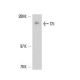 C5 Antibody (557) - Western Blotting - Image 17319