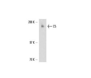C5 Antibody (561) - Western Blotting - Image 17318