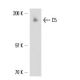 C5 Antibody (561) - Western Blotting - Image 17318
