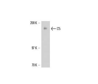 C5 Antibody (6A532) - Western Blotting - Image 17321
