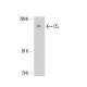 C5 Antibody (6A532) - Western Blotting - Image 17321