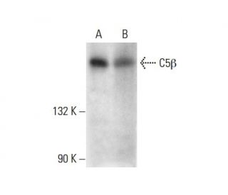 C5&beta; Antibody (E-8) - Western Blotting - Image 303441