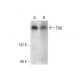 C5β Antibody (E-8) - Western Blotting - Image 303441