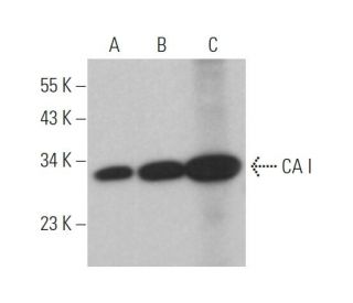 CA I Antibody (C-6) - Western Blotting - Image 374513 
