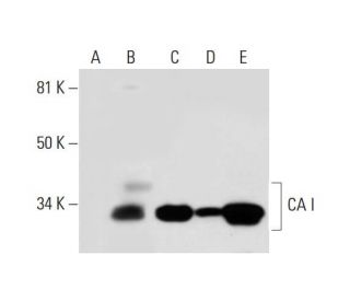 CA I Antibody (F-5) - Western Blotting - Image 295972 