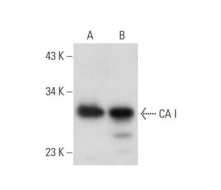 CA I Antibody (G-6) - Western Blotting - Image 300520 