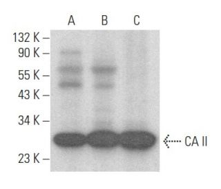 CA II Antibody (C-10) - Western Blotting - Image 355190 
