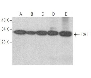 CA II Antibody (D-8) - Western Blotting - Image 355187 