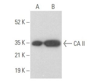 CA II Antibody (H-10) - Western Blotting - Image 355460 