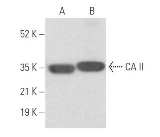 western blotting image from recommended CA II (G-2) monoclonal antibody replacement. Image 355459