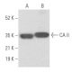 This polyclonal antibody has been discontinued. See our recommended <a href="ca-ii-antibody-g-2">CA II (G-2)</a> monoclonal antibody (sample data shown). western blotting image from recommended CA II (G-2) monoclonal antibody replacement. Image 355459