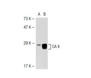 CA II Antibody (H-10) - Western Blotting - Image 41549