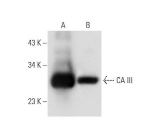 CA III Antibody (B-2) - Western Blotting - Image 304307 