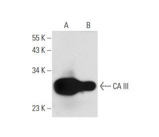 CA III Antibody (B-9) - Western Blotting - Image 294572 