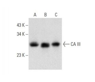 CA III Antibody (G-5) - Western Blotting - Image 309515