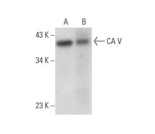 CA V Antibody (A-1) - Western Blotting - Image 301461 
