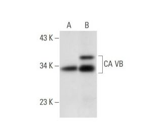 CA VB Antibody (D-9) - Western Blotting - Image 299148 
