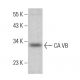 CA VB Antibody (D-9) - Western Blotting - Image 383724