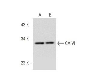 CA VI Antibody (H-8) - Western Blotting - Image 331203 