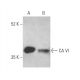 CA VI Antibody (H-8) - Western Blotting - Image 400976