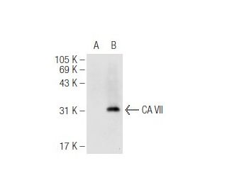 CA VII Antibody (G-7) - Western Blotting - Image 93682