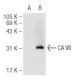 CA VII Antibody (G-7) - Western Blotting - Image 93682