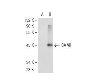 CA VII Antibody (H-4) - Western Blotting - Image 108887