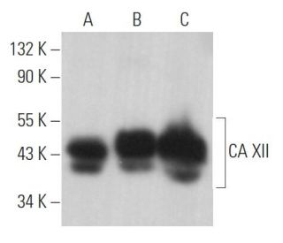 CA XII Antibody (A-3) - Western Blotting - Image 362824 