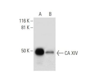 CA XIV Antibody (C-12) - Western Blotting - Image 300114 