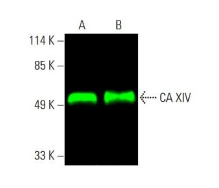 western blotting image from recommended CA XIV (A-4) monoclonal antibody replacement. Image 387295