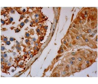 Cables2 Antibody (D-6) - Immunohistochemistry - Image 286293 