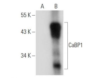 CaBP1 Antibody (F-5) - Western Blotting - Image 319294
