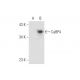 CaBP4 Antibody (H-9) - Western Blotting - Image 332768