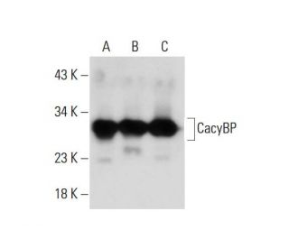 CacyBP Antibody (A-10) - Western Blotting - Image 129926 